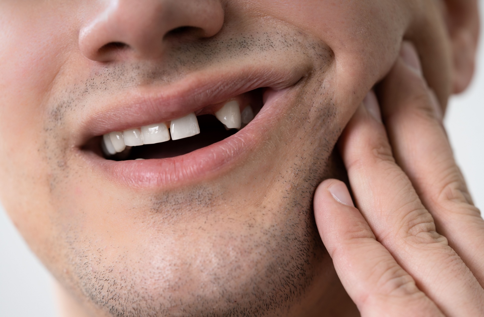 A person holding their hand up to their jaw while missing a tooth after an accident