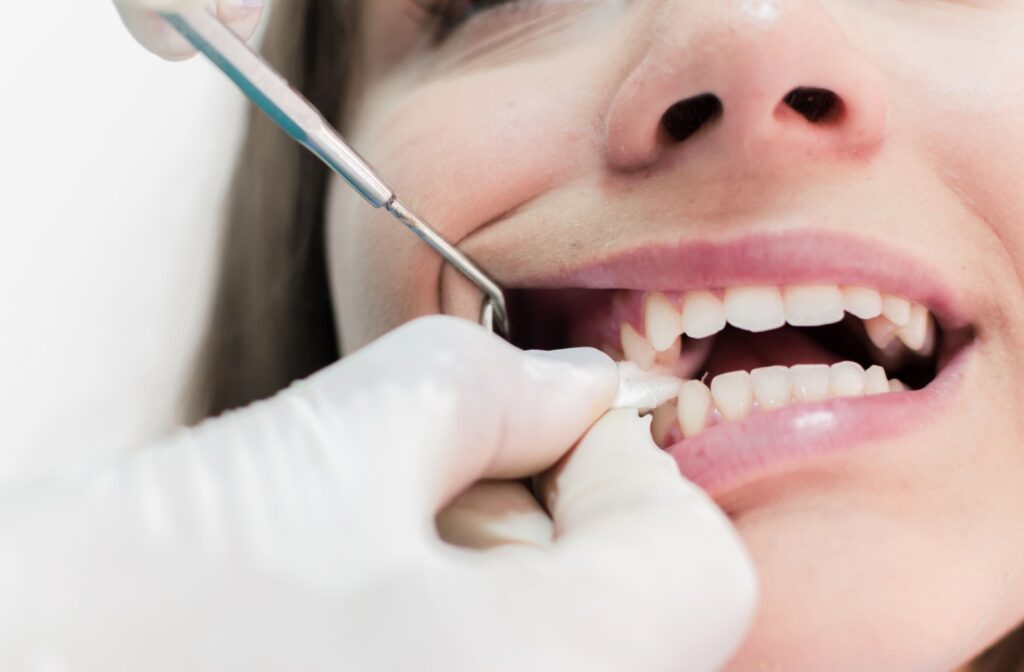 A dentist putting gauze in a patients mouth after a tooth extraction